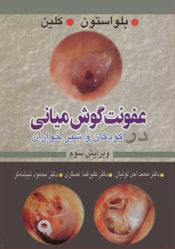 عفونت گوش میانی کودکان و شیرخواران