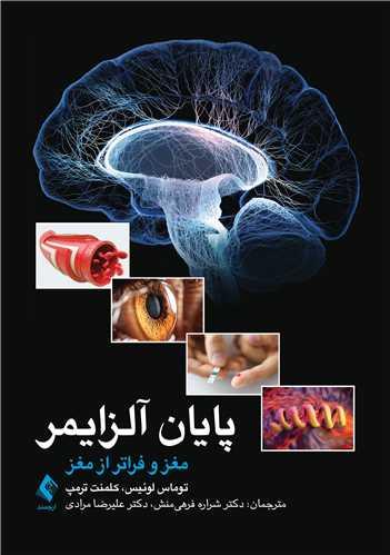 پایان آلزایمر
مغز و فراتر از مغز